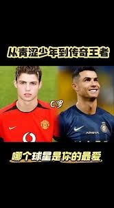 迪马：罗韦拉耻骨炎保守治疗未达预期，若手术将缺席40-45天